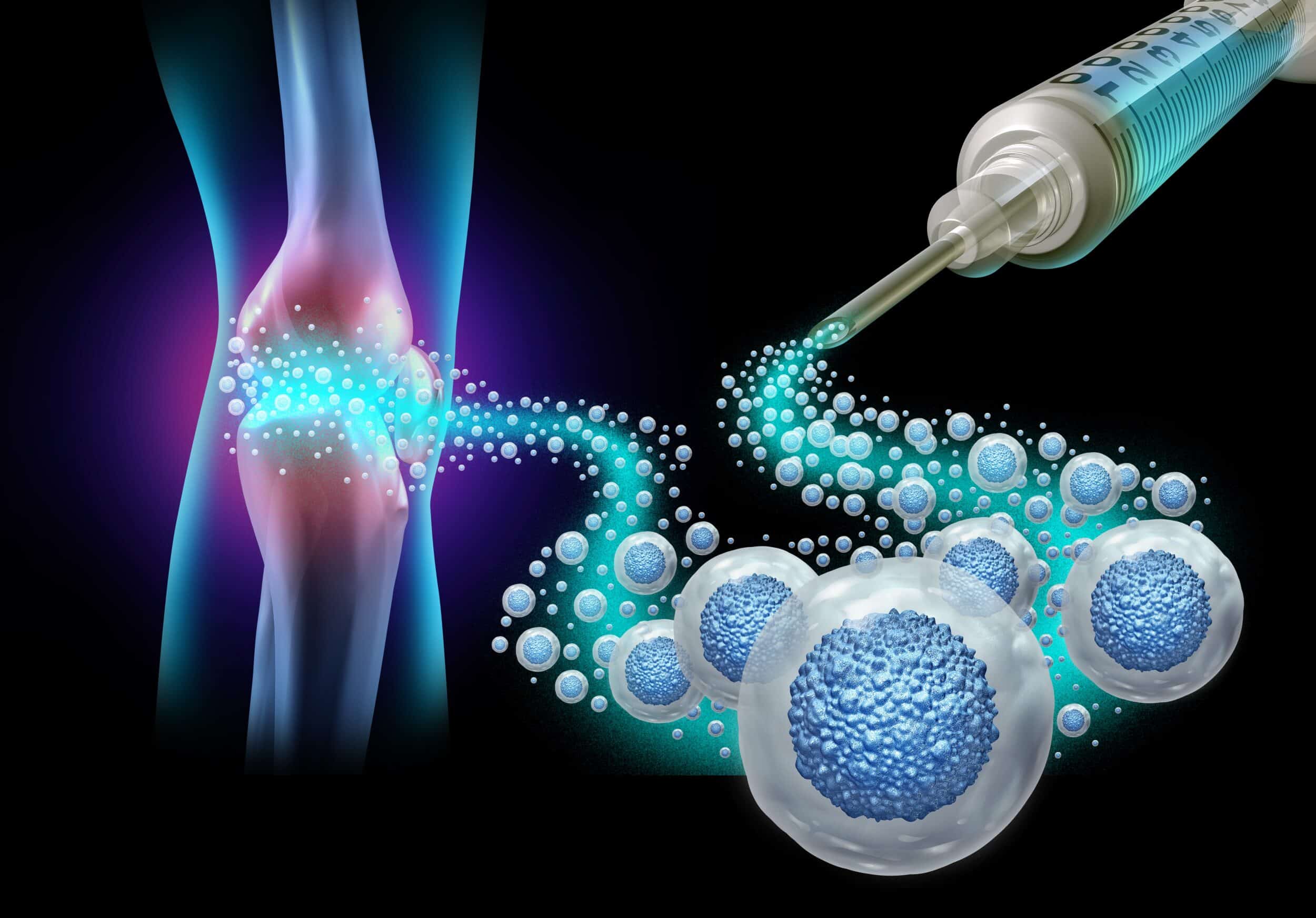 Regenerative,Medicine,And,Mesenchymal,Stem,Cells,Injected,For,Knee,Joint