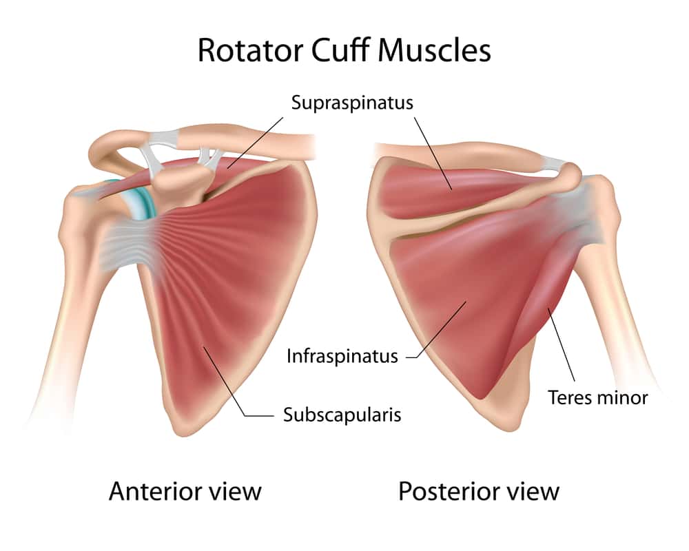 Rotator Cuff Repair